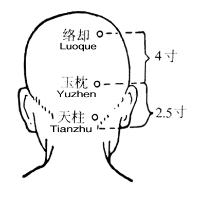 天柱
