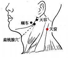 天窗
