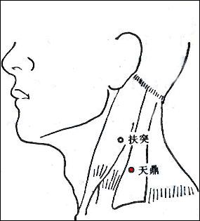 天鼎 第1张 天鼎