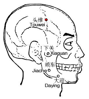 头维 第1张 头维