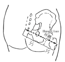环跳
