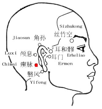 瘈脉 第1张 瘈脉