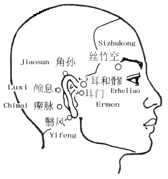 翳风